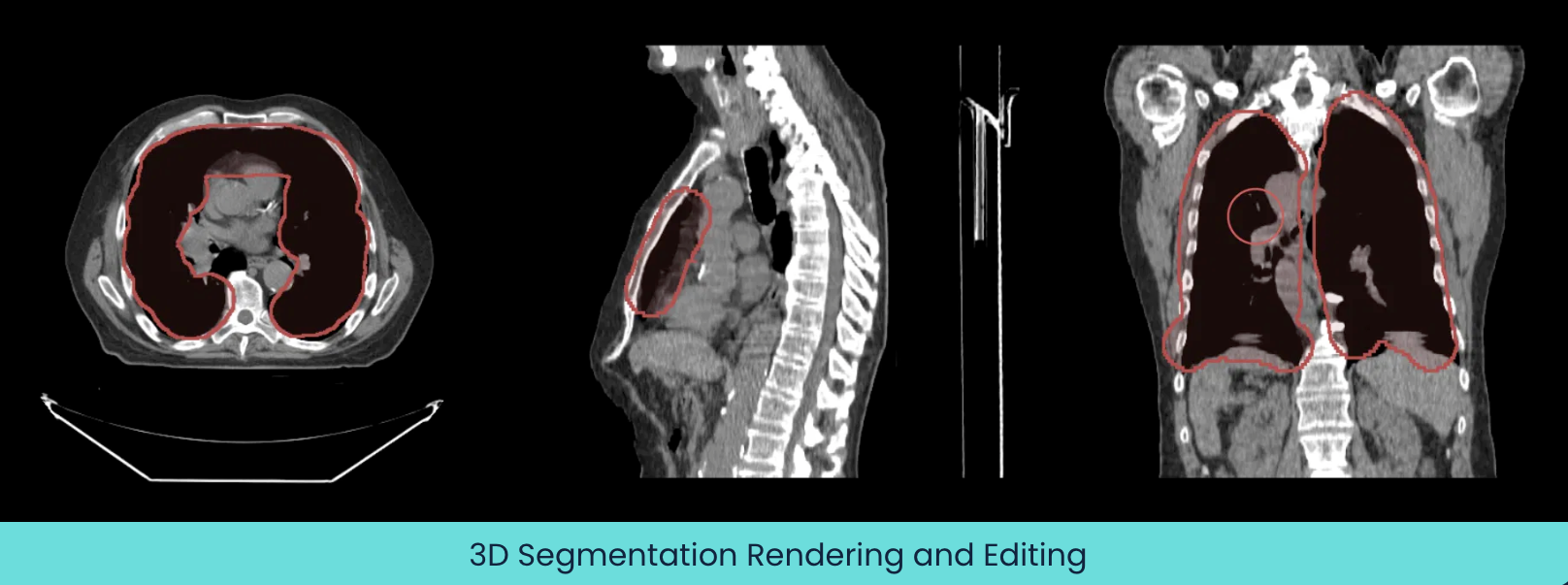 3D-Segmentation-Rendering-and-Editing