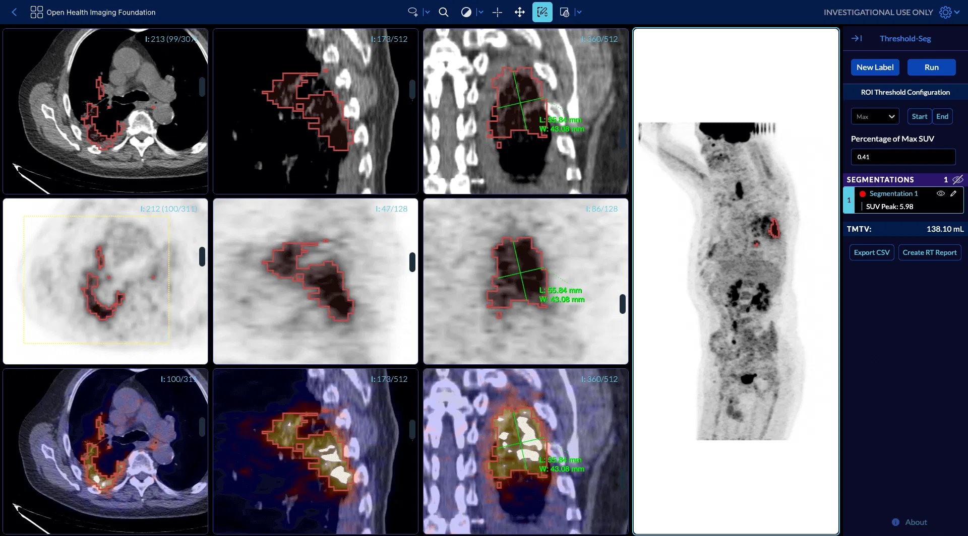 banners show Advanced Visualizations and Analysis