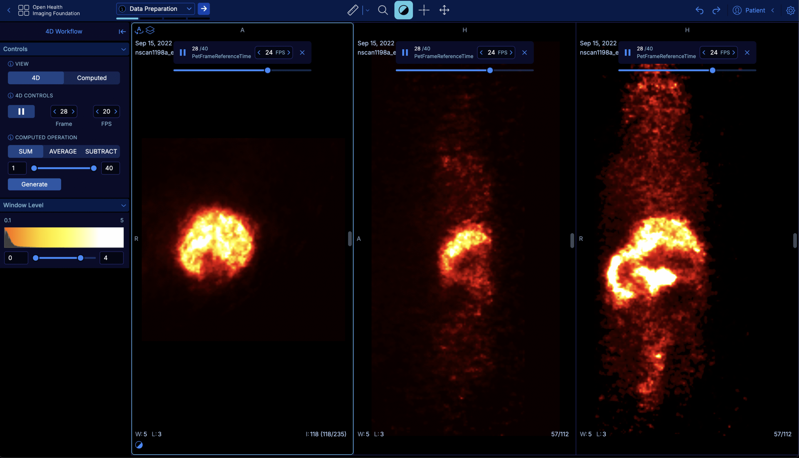 OHIF Viewer's preclinical 4D workflow showing Data Preparation on a PET-CT scan.