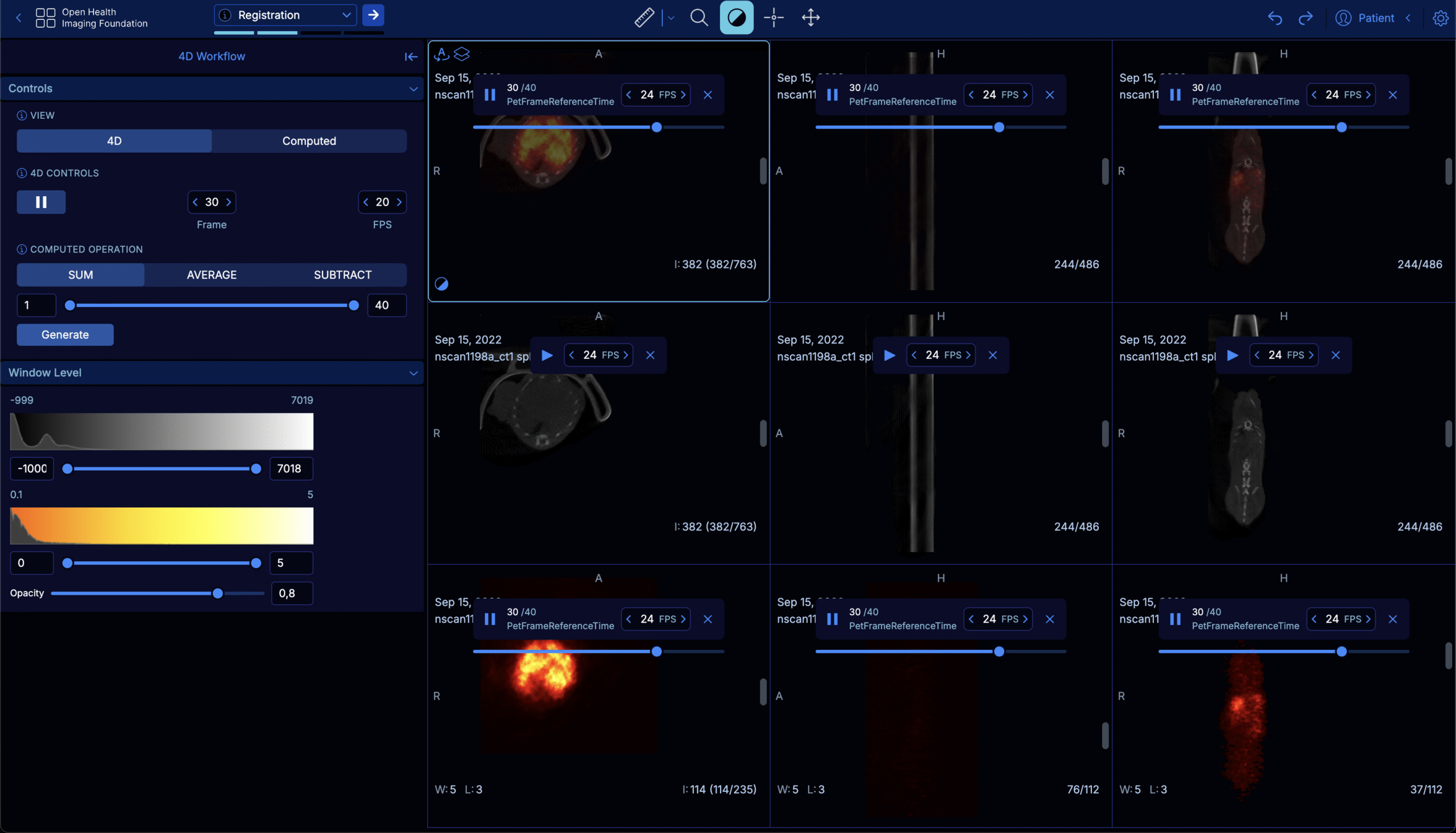 OHIF Viewer's 4D preclinical workflow showing image registration of PET-CT scans across a 3x3 grid.