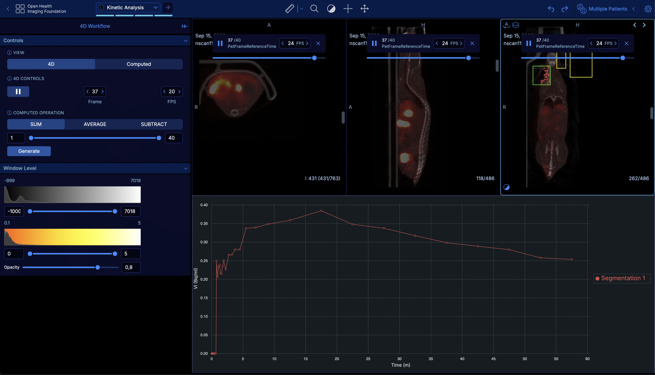 OHIF Viewer performing kinetic analysis with a time-activity curve chart for preclinical PET-CT data.