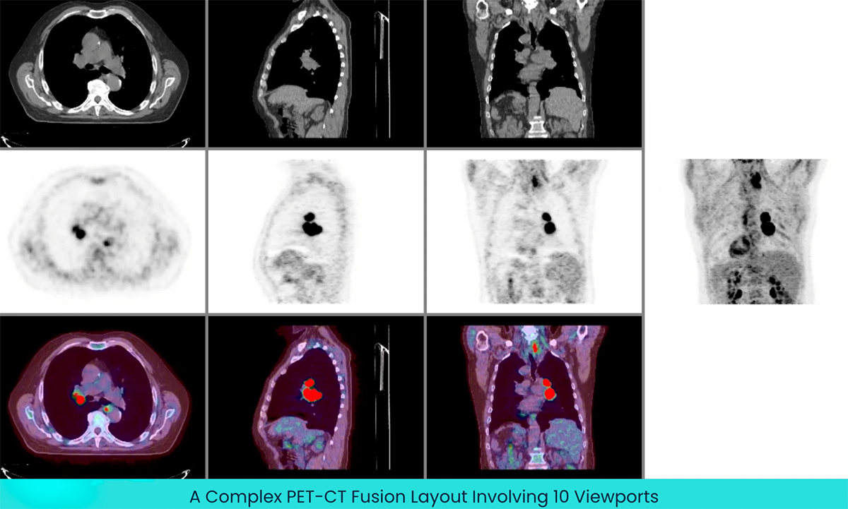 A-Complex-PET-CT-Fusion-Layout-Involving-10-Viewports